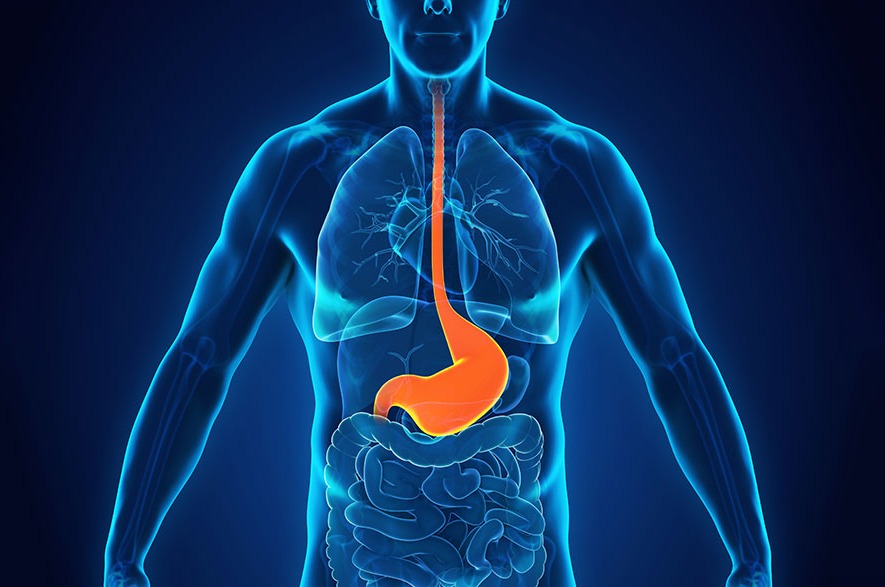 GERD Reflux Causes,Symptoms,Treatment,Preventive Measures